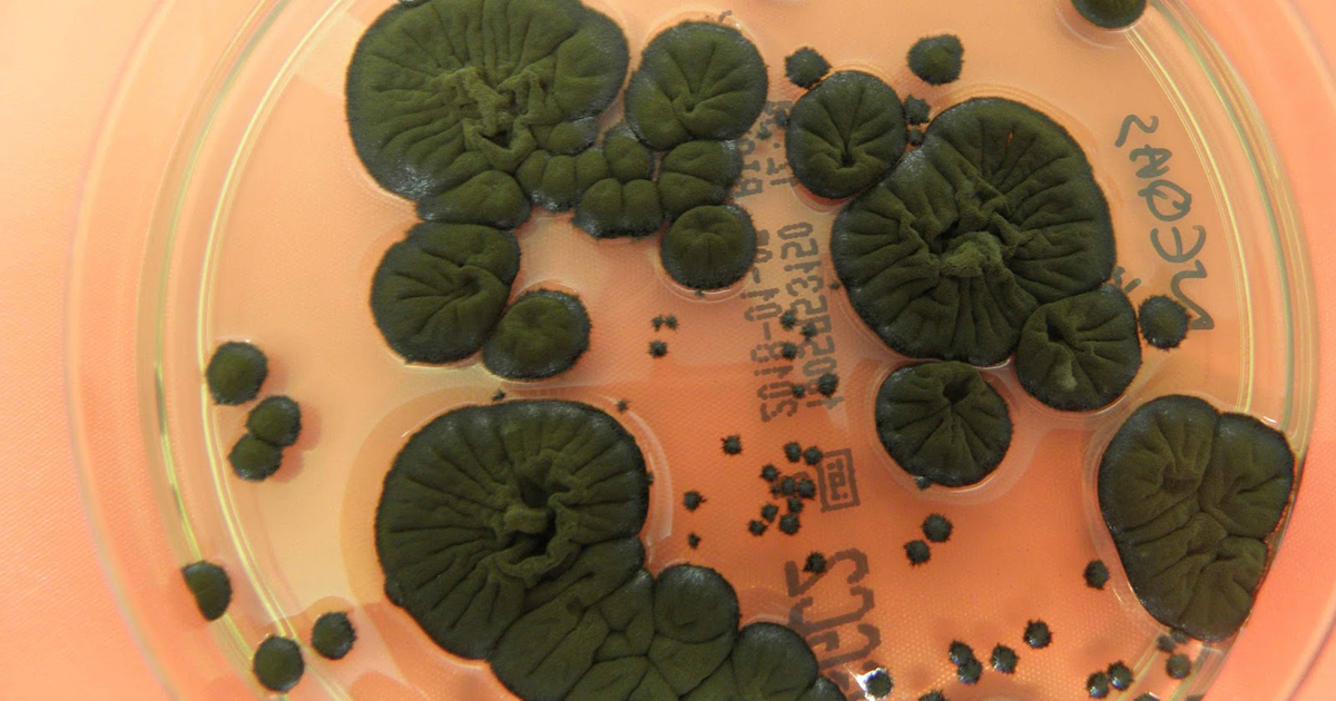 Чорнобильський грибок перетворює радіацію на енергію для життя