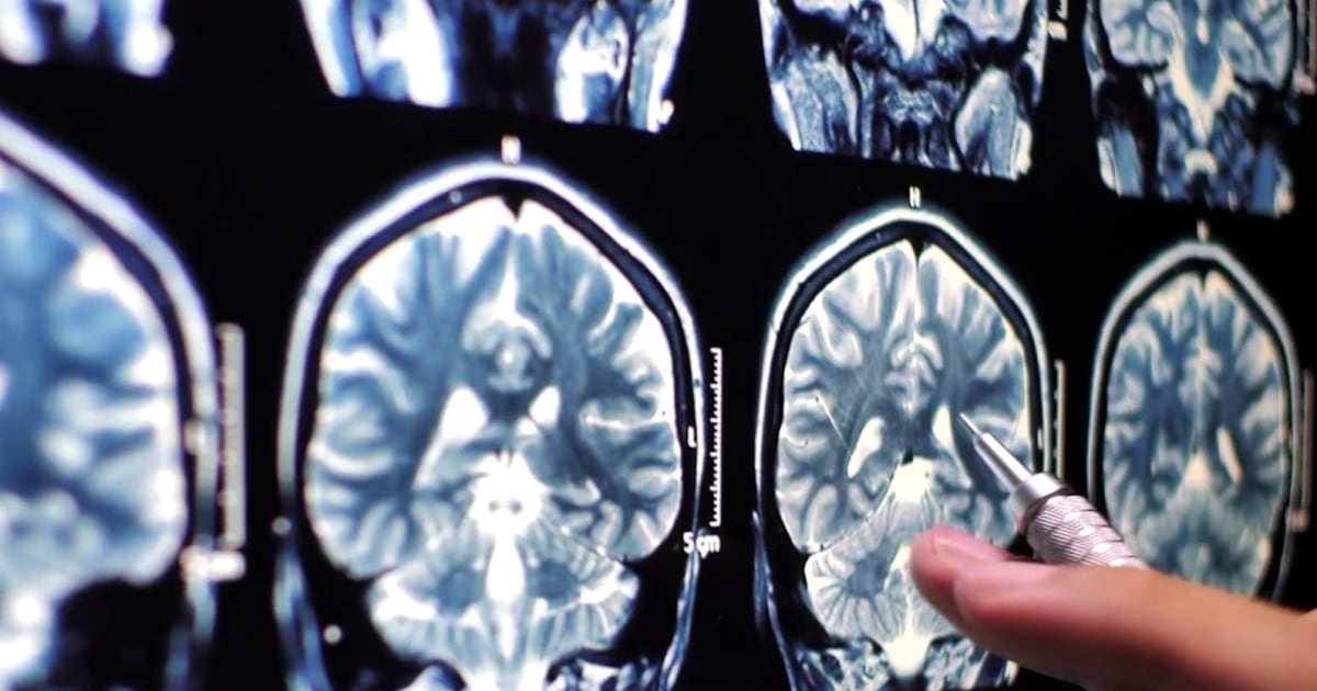 Як космос впливає на мозок астронавтів: нові дослідження