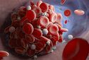 AstraZeneca: почему развивается тромбоз?