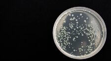 Форма бактерий влияет на их устойчивость