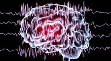 Нарушения памяти при эпилепсии объяснили дисфункцией группы нейронов