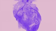 Инженеры создали биорастворимый беспроводной кардиостимулятор