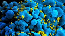 Технологию редактирования генов CRISPR впервые изучат для лечения ВИЧ
